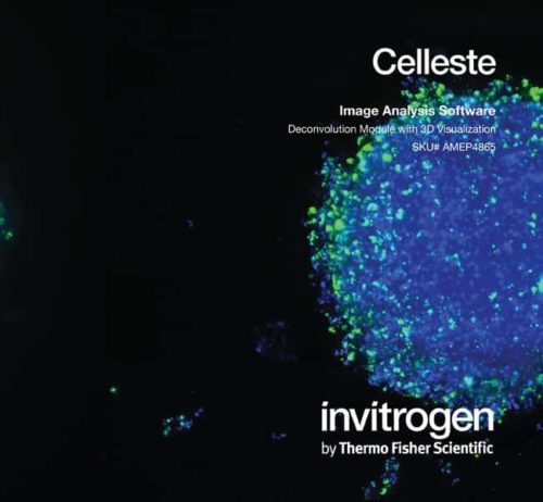 Invitrogen Celleste 5.0 Модуль 3D слепой/неслепой деконволюции Включает: | Фишер Сайентифик