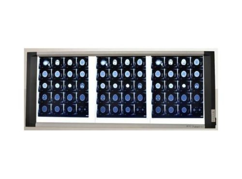 Bio-x X-Ray View Box Triple Screen High End Version