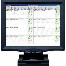 Central Patient Monitoring System